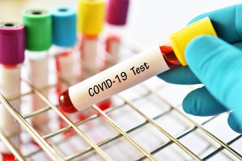 Nuevo tipo Covid-19 Reactivos de prueba de diagnóstico rápido en Singapur